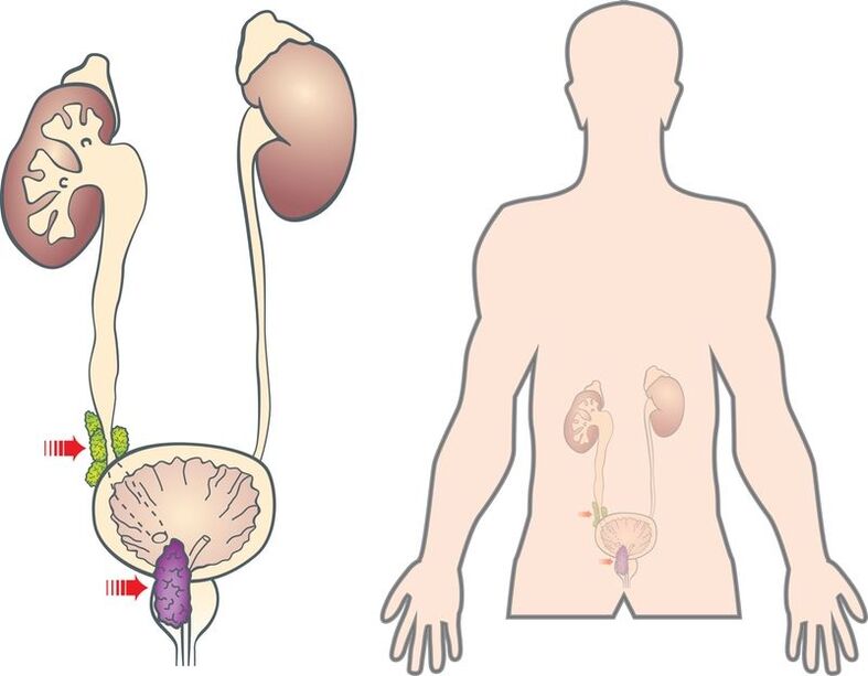 symptômes et causes de l'adénome de la prostate